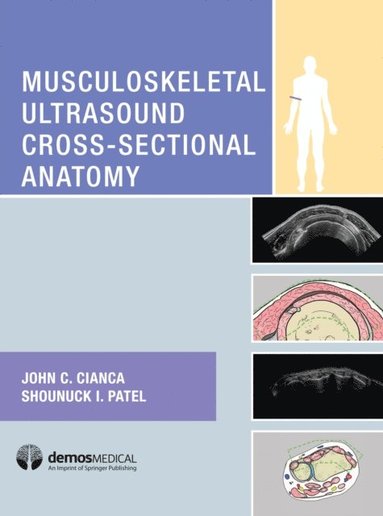 Musculoskeletal Ultrasound Cross-Sectional Anatomy (e-bok)