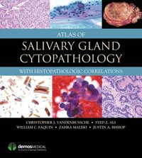 Atlas of Salivary Gland Cytopathology (e-bok)