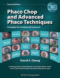 Phaco Chop and Advanced Phaco Techniques (inbunden)