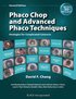Phaco Chop and Advanced Phaco Techniques