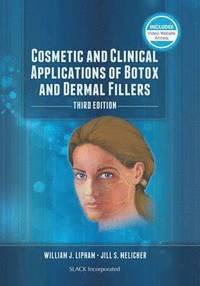 Cosmetic and Clinical Applications of Botox and Dermal Fillers (inbunden)