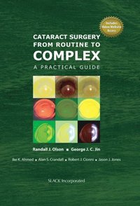 Cataract Surgery from Routine to Complex (e-bok)