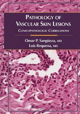 Pathology of Vascular Skin Lesions (hftad)