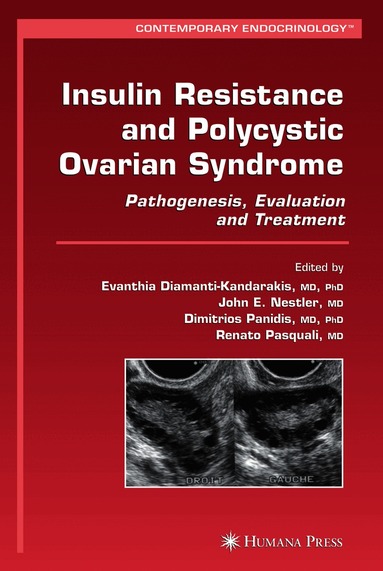 Insulin Resistance and Polycystic Ovarian Syndrome (h�ftad)