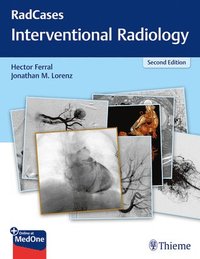 RadCases Q&A Interventional Radiology (häftad)