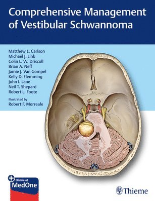 Comprehensive Management of Vestibular Schwannoma (inbunden)