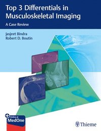 Top 3 Differentials in Musculoskeletal Imaging (häftad)