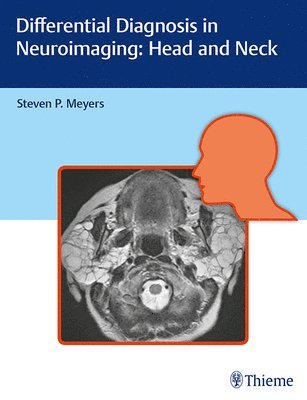 Differential Diagnosis in Neuroimaging: Head and Neck (inbunden)