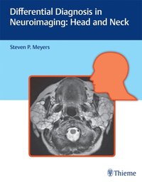 Differential Diagnosis in Neuroimaging: Head and Neck (e-bok)