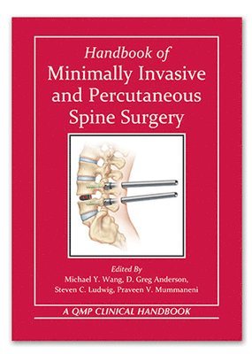 Handbook of Minimally Invasive and Percutaneous Spine Surgery (hftad)