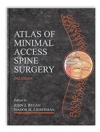 Atlas of Minimal Access Spine Surgery (inbunden)