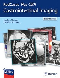 RadCases Plus Q&A Gastrointestinal Imaging (häftad)