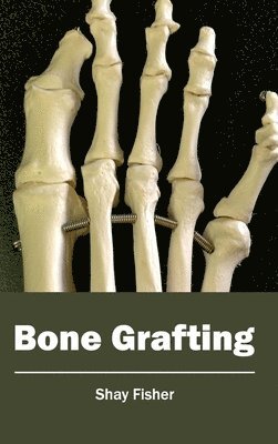 Bone Grafting (häftad)