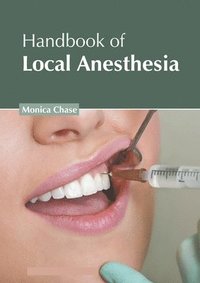 Handbook Of Local Anesthesia - Monica Chase - Bok (9781639275359) | Bokus