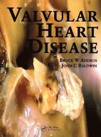 Valvular Heart Disease (hftad)