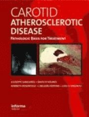Carotid Atherosclerotic Disease (inbunden)