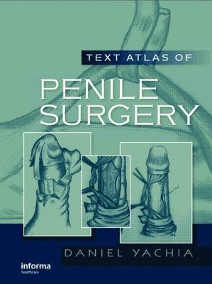 Text Atlas of Penile Surgery (häftad)