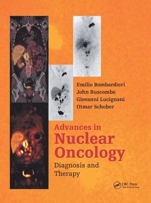Advances in Nuclear Oncology: (inbunden)