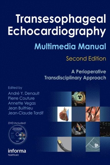 Transesophageal Echocardiography Multimedia Manual (e-bok)