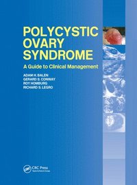 Polycystic Ovary Syndrome (inbunden)