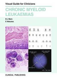 Chronic Myeloid Leukaemias (inbunden)