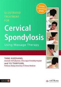 Illustrated Treatment for Cervical Spondylosis Using Massage Therapy (hftad)