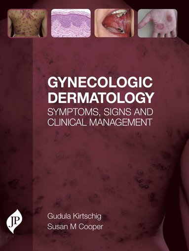 Gynecologic Dermatology (häftad)
