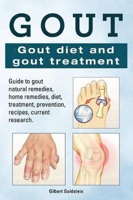 Gout. Gout diet and gout treatment. Guide to gout natural remedies, home remedies, diet, treatment, prevention, recipes, current research. (inbunden)