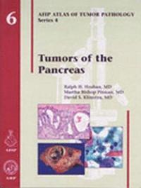 Tumors of the Pancreas (inbunden)