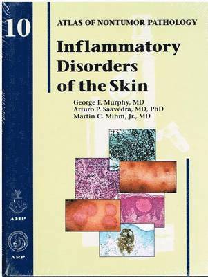 Inflammatory Disorders of the Skin (inbunden)