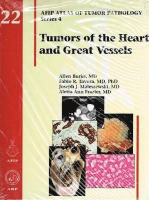 Tumors of the Heart and Great Vessels (inbunden)