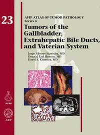 Tumors of the Gallbladder, Extrahepatic Bile Ducts, and Vaterian System (inbunden)