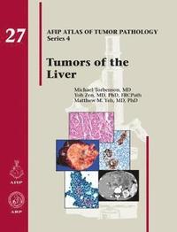 Tumors of the Liver (inbunden)