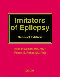 Imitators of Epilepsy (e-bok)