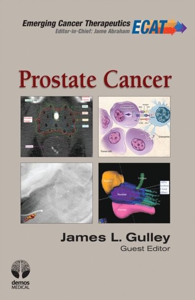 Prostate Cancer (e-bok)