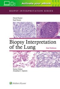 Biopsy Interpretation of the Lung (inbunden)