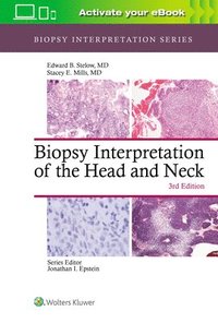 Biopsy Interpretation of the Head and Neck (inbunden)