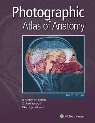 Photographic Atlas of Anatomy (hftad)