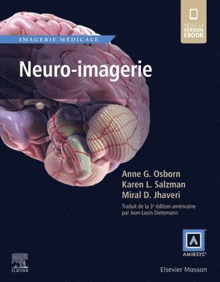 Neuro-imagerie (h�ftad)
