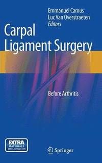 Carpal Ligament Surgery (inbunden)