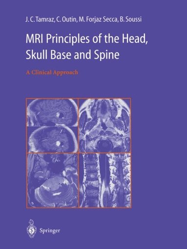 MRI Principles of the Head, Skull Base and Spine (e-bok)