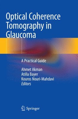 Optical Coherence Tomography in Glaucoma (hftad)