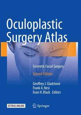 Oculoplastic Surgery Atlas (hftad)