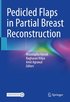 Pedicled Flaps in Partial Breast Reconstruction