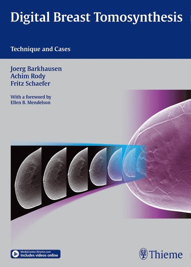 Digital Breast Tomosynthesis (h�ftad)