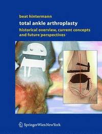 Total Ankle Arthroplasty (inbunden)