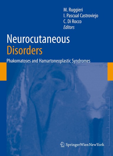 Neurocutaneous Disorders (inbunden)