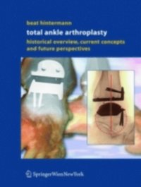 Total Ankle Arthroplasty (e-bok)