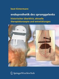 Endoprothetik des Sprunggelenks (e-bok)