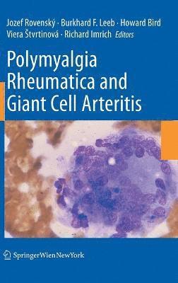Polymyalgia Rheumatica and Giant Cell Arteritis (inbunden)